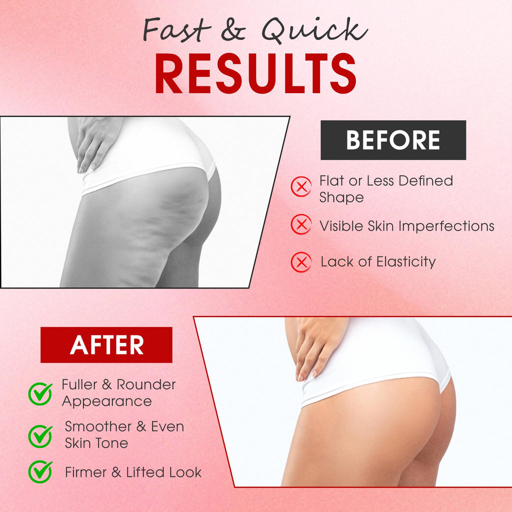 Brazilian Butt Lift & Enhancement Cream - Natural Firming & Volume
